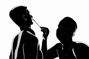 新型コロナウイルス感染症に対する水際対策としても重要なPCR検査。中国では最近、一部の入国者に対して肛門から検体を採取するPCR検査が行われているとして、在中国日本大使館が日本人に実施しないよう中国側に申し入れたと伝えられた。(イメージ写真提供:123RF)